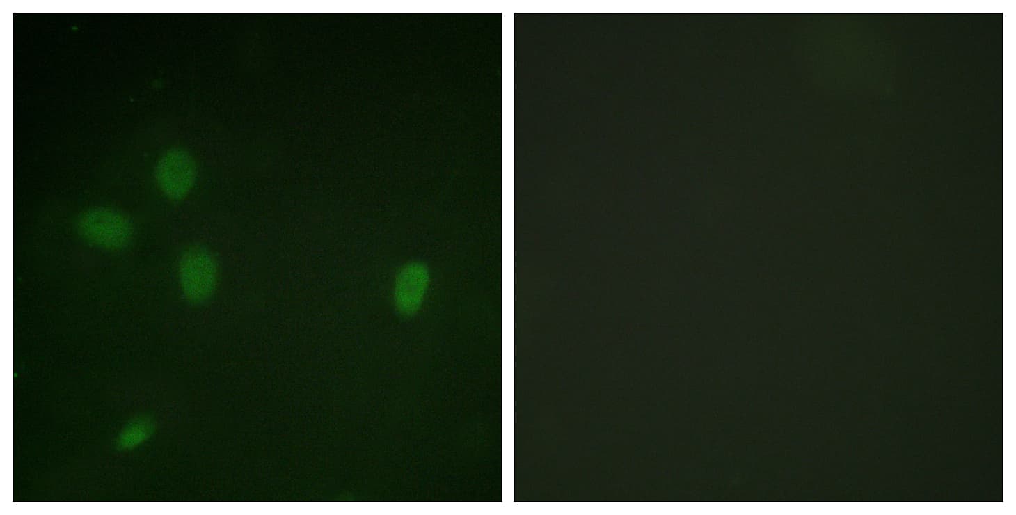 TP53BP1 / 53BP1 Antibody (phospho-Ser25)