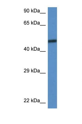 BAF60C / SMARCD3 Antibody (C-Terminus)