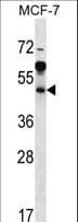 ARFIP1 Antibody (aa147-176)