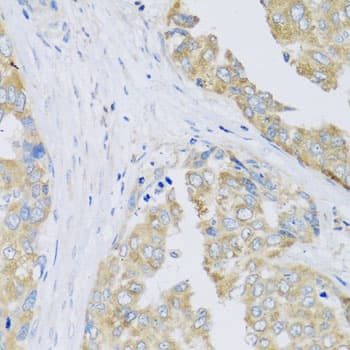 ARFGAP3 Antibody (AP)