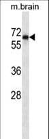 PTPN11 / SHP-2 / NS1 Antibody