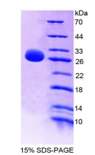 Mouse CD274 / B7-H1 / PD-L1 Protein (Recombinant His-T7)