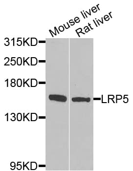 Polyclonal Rabbit anti-Human LRP5 Antibody (aa1000-1250, IHC, WB)