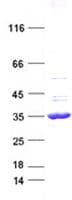 Human CCND1 / Cyclin D1 Protein (Recombinant DDK,C-terminus)