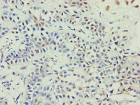 Polyclonal Rabbit anti-Human ABCE1 Antibody (aa320-599, IHC, WB)