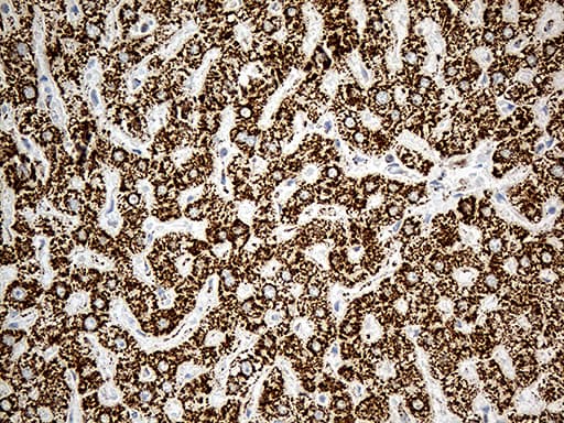 MCAD / ACADM Antibody (clone OTI10A5, Carrier-free)