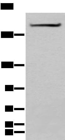 SPTA1 / Alpha Spectrin Antibody