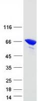Human LMNA / Lamin A+C Protein (Recombinant Myc-DDK (Flag))