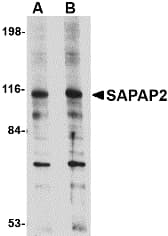 IHC-plus™ DLGAP2 Antibody