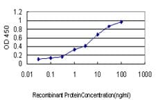 FBXL18 Antibody (clone 3H5)