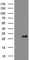 Thymidylate Kinase Antibody (clone OTI2D1, Carrier-free)
