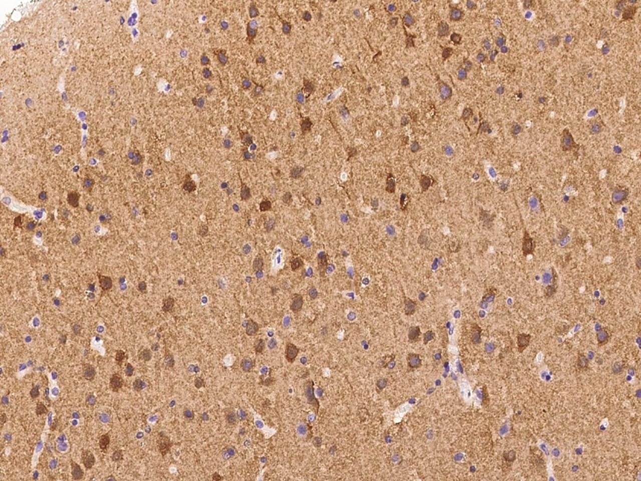 PPP3CB Antibody