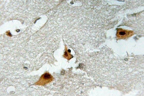 Polyclonal Rabbit anti-Human FOXO4 / AFX1 Antibody (phospho-Ser197, IHC, WB)