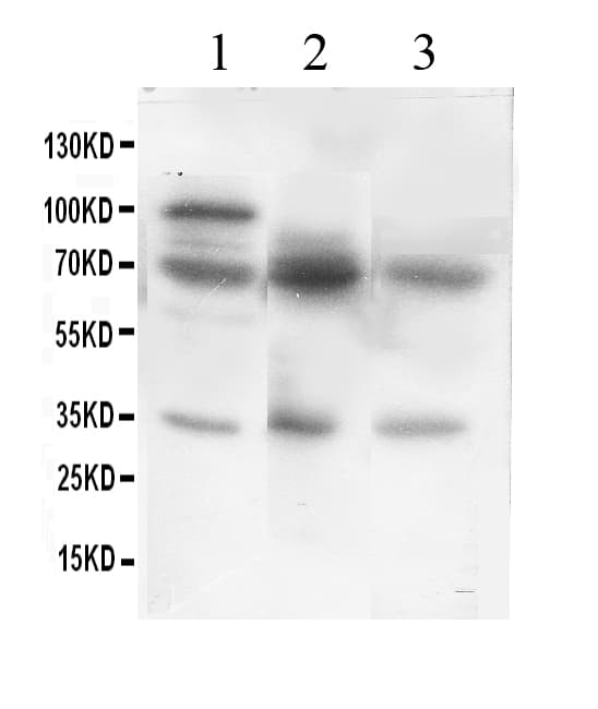 GAD1 / GAD67 Antibody (aa14-122)
