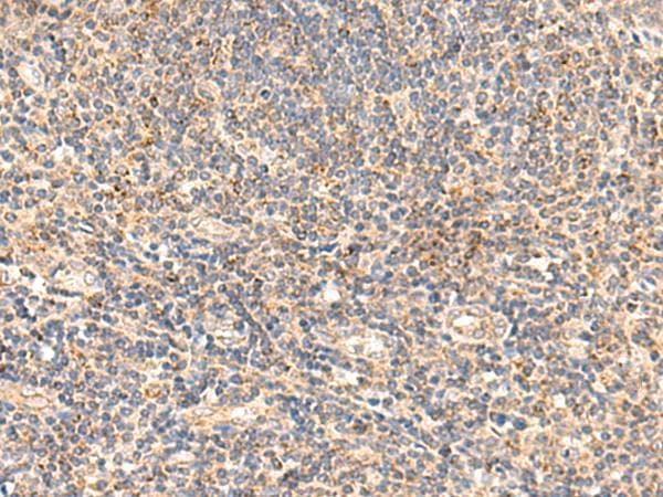 GSTK1 Antibody