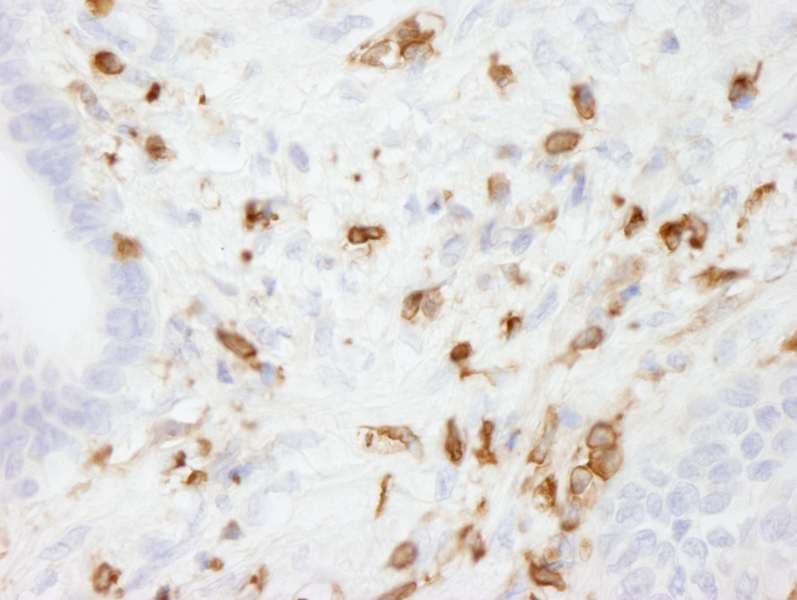 Polyclonal Rabbit anti-Human CORO1A / Coronin 1a Antibody (aa250-300, IHC)