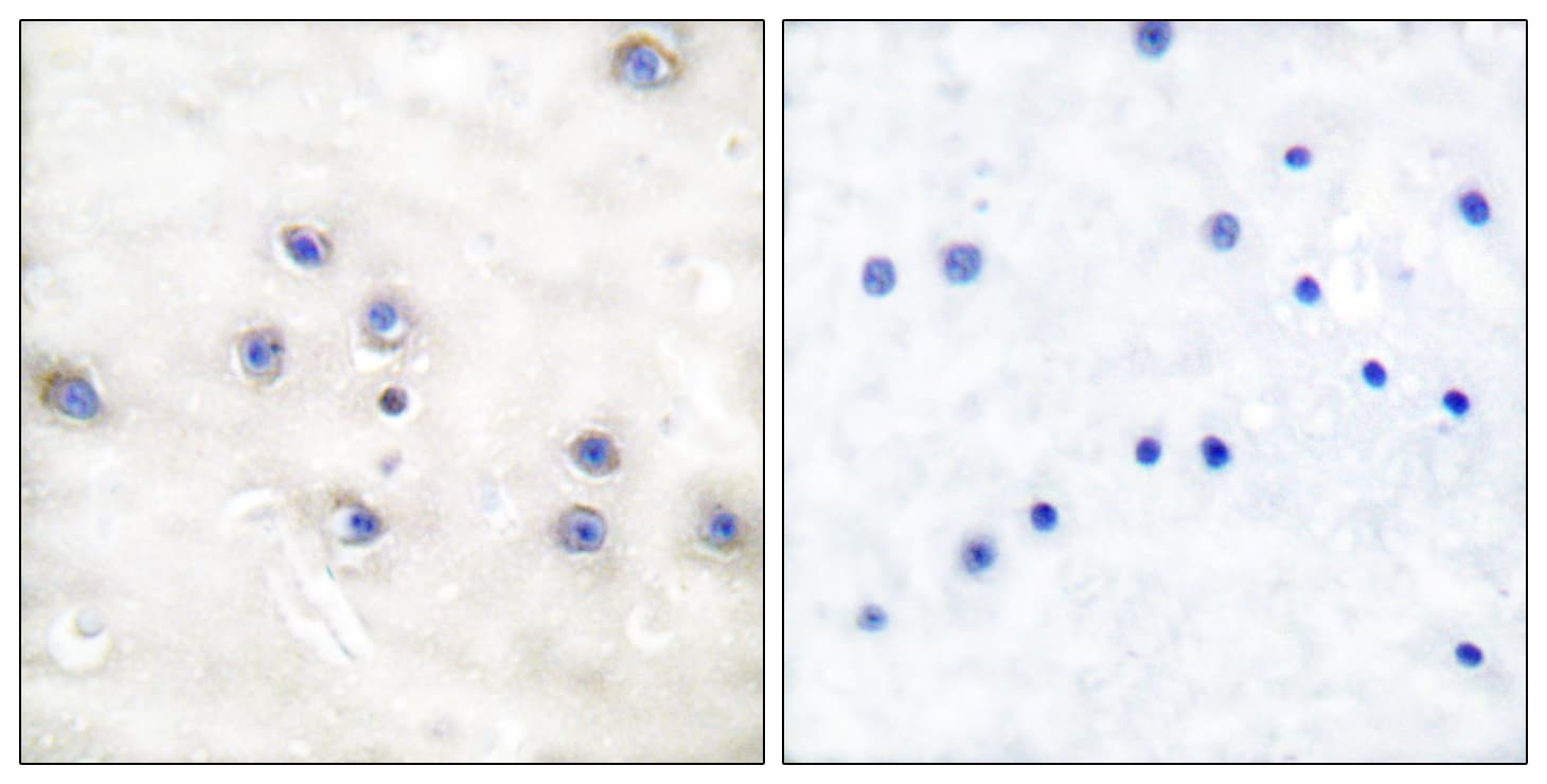 Polyclonal Rabbit anti-Human MAP3K8 / TPL2 Antibody (aa256-305, IHC, IF, WB)