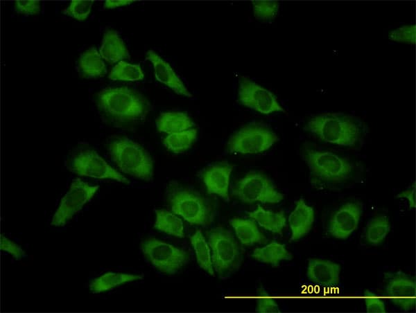 Monoclonal Mouse anti-Human HARS Antibody (clone 1C8, IF, WB)