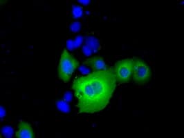IHC-plus™ RANGAP1 Antibody (clone 1B4)
