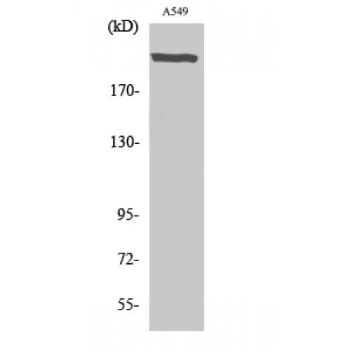 UBR5 Antibody (1-80 aa, N-terminal)