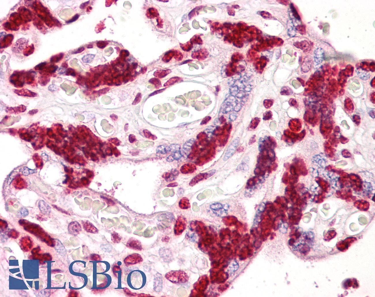 IHC-plus™ IPP2 / PPP1R2 Antibody (aa86-135)