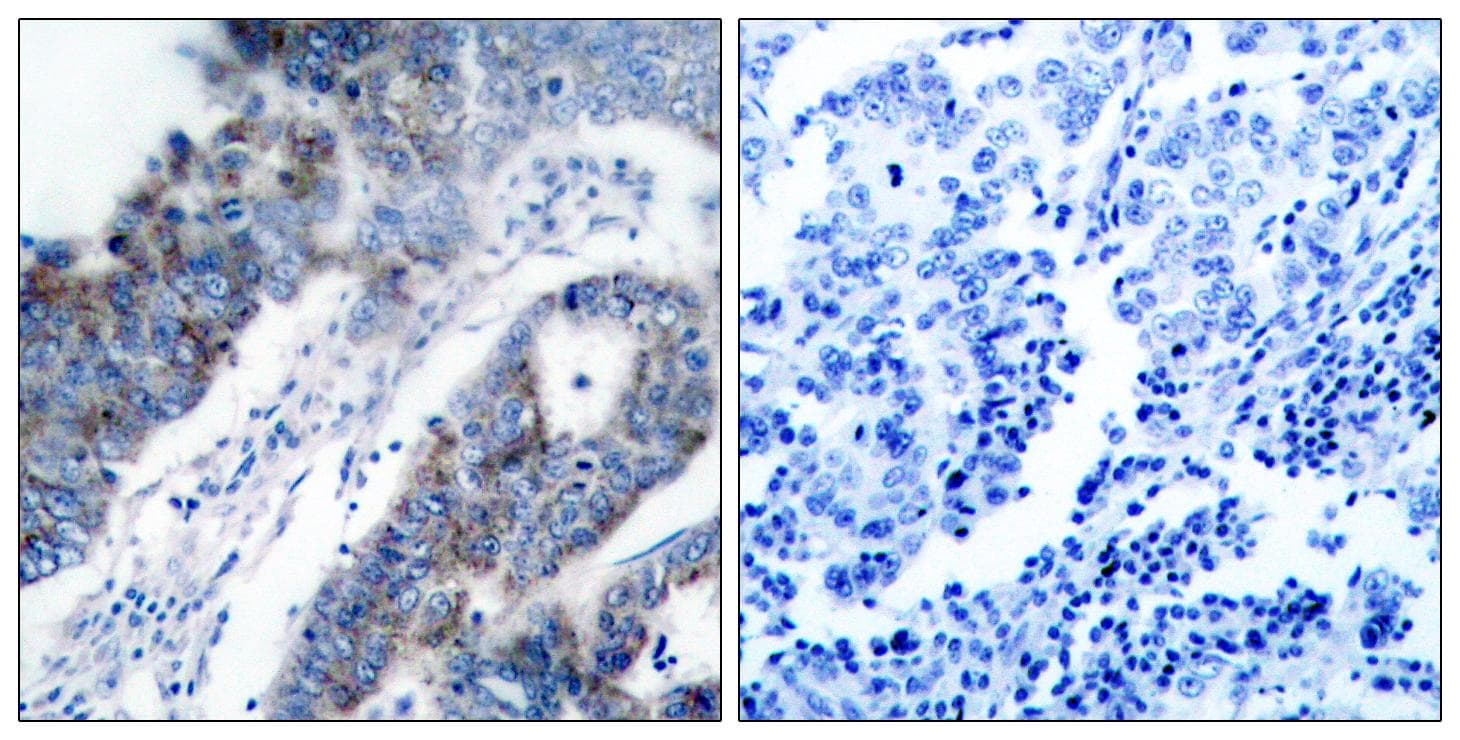 Polyclonal Rabbit anti-Human MAP3K5 / ASK1 Antibody (p83, IHC, WB)