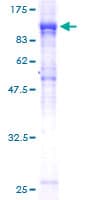 Human NUP85 / Pericentrin 1 Protein (Recombinant GST)
