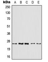 Polyclonal Rabbit anti-Human ARF4 Antibody (Internal, IHC, WB)