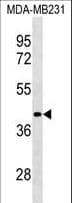 Polyclonal Rabbit anti-Human LRRC39 Antibody (aa15-41, WB)