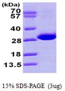 Human CBR4 Protein (Recombinant His)
