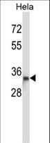 DTNBP1 / Dysbindin Antibody (aa10-38)