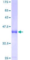 Human CENPM Protein (Recombinant GST)