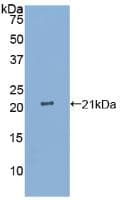 Human IL25 / IL17E Protein (Recombinant His, N-Terminal)