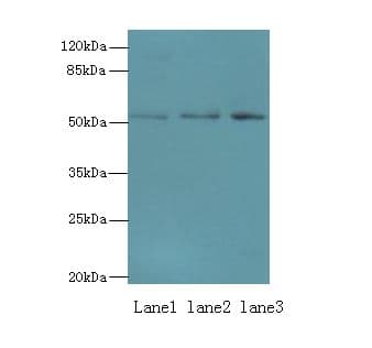 PPP2R2B Antibody