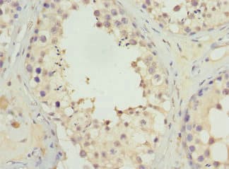 Polyclonal Rabbit anti-Human UGT3A2 Antibody (IHC)