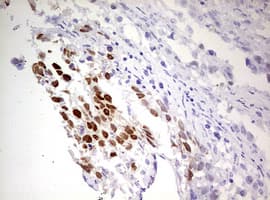 FBXW7 / FBW7 Antibody (aa1-354, clone OTI4C11)