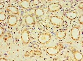 Polyclonal Rabbit anti-Human DACT3 Antibody (aa1-160, IHC)
