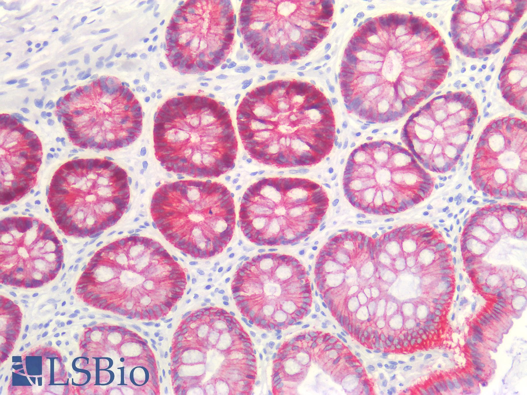 PathPlus™ Monoclonal Mouse anti-Human CLDN3 / Claudin 3 Antibody (clone ABT-CLD3, IHC, WB)