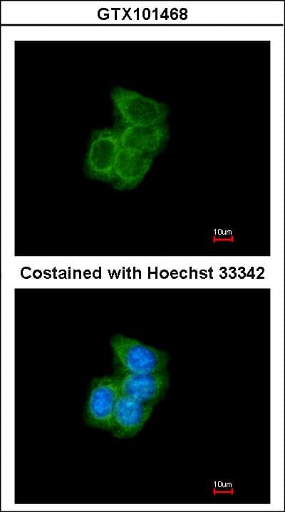 PDI / P4HB Antibody (aa23-227)