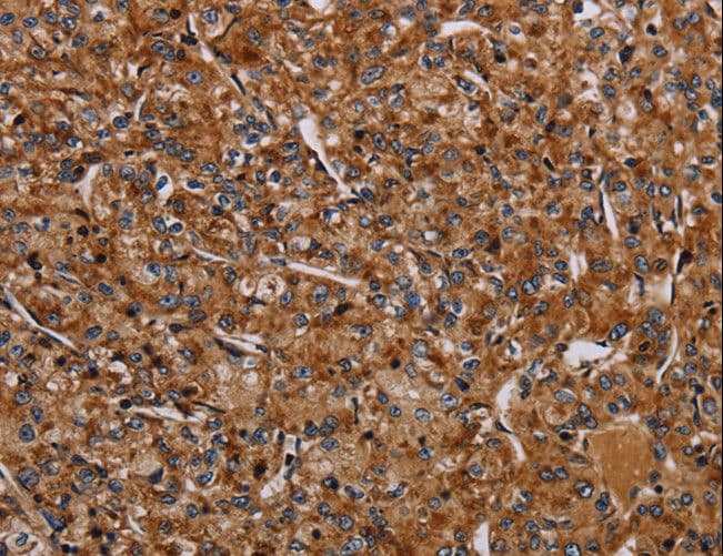 NDUFA8 Antibody