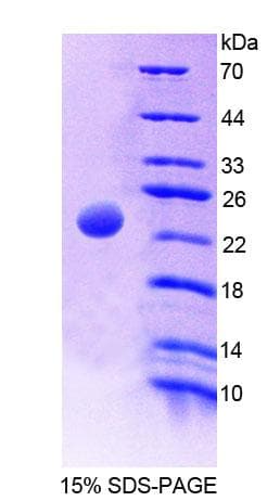Rat AK2 / Adenylate Kinase 2 Protein (Recombinant His-T7)