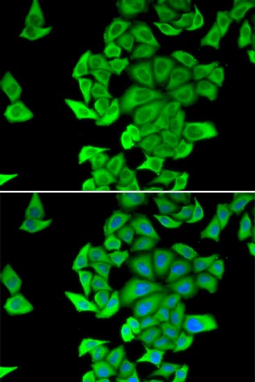 SMYD2 Antibody