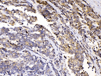 Polyclonal Rabbit anti-Human PRKAR1A Antibody (IHC, WB)
