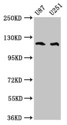 ABL2 Antibody