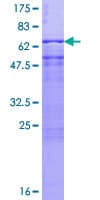 Human PSMD6 Protein (Recombinant GST)