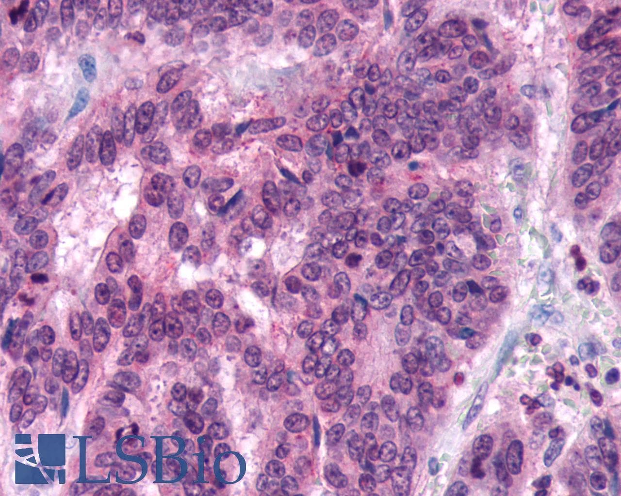 PathPlus™ FZD5 / Frizzled 5 Antibody (N-Terminus)