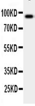 CSF3R / CD114 Antibody (aa254-271)