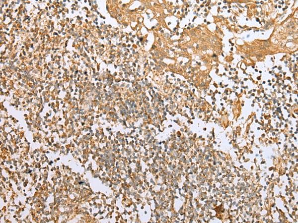NDUFB3 Antibody