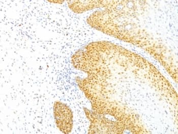 CDKN1B / p27 Kip1 Antibody (clone KIP1/769)