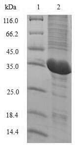 Rabbit IL2 Protein (Recombinant 6His, N-terminus)
